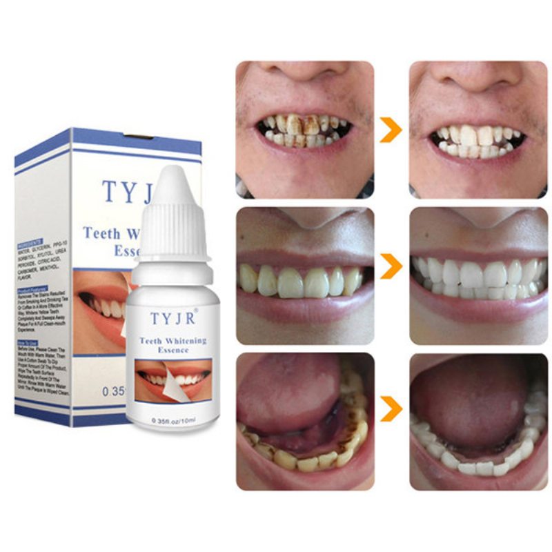 Teeth Whitening Liquid Remove Plaque Stain Yellow Smoke Oral Hygiene Cleaning 10 Ml